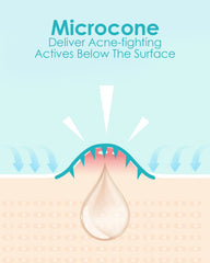 +1HEROLABS Parche acne con acido salicilico para piel sensible.