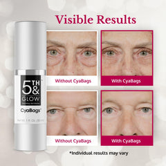 Application scene of Cyabags under-eye serum for gentle patting and absorption.