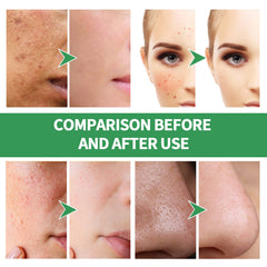 Aacnre Centella, mascarilla burbuja con efecto hidratante ligero y agradable.