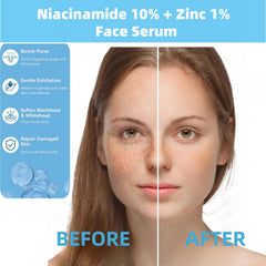 AFCRYIYE serum bottle label close-up highlights zinc and niacinamide.