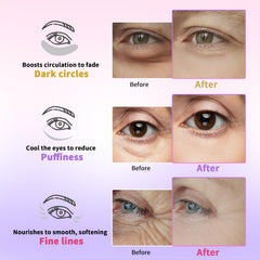 Parches AILEORY cafeína para reducir hinchazón y cansancio de ojos.