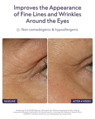 ALASTIN Restorative Eye Complex cream texture swatch on skin, hinting hydration.