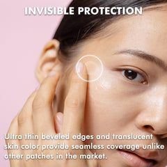 Albatross Health New England 12mm patches provide discreet coverage for medium blemishes