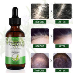 ALIVER aceite de romero para aplicación capilar, nutrición del cuero cabelludo