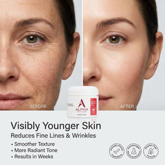 Crema antiarrugas de Alpha Skin Care con textura sedosa para uso diario.