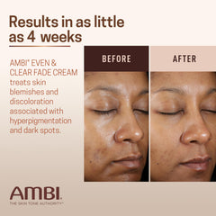 Ambi Even & Clear con Vitamina C para iluminar manchas.