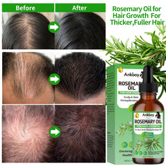 ANKOOY Rosemary Oil hair growth focus for thicker-looking strands.