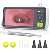 Anykit otoscope with 4.5-inch display shows clear ear visuals for home checks.