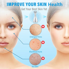 AOEDEO nano-ionic face steamer steam mist delivers gentle warmth for facial use.