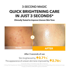 Con APRILSKIN A.C.E Serum, tono más uniforme y claridad.