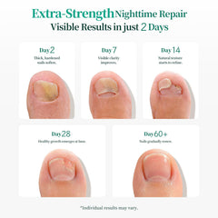 APUREE convenient, mess-free nail patch in use