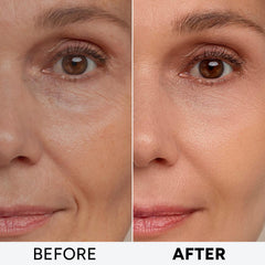 Arvesa aplicación suave de crema en el rostro con masaje.