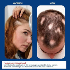 ATHNO Kormesic resultados de densidad y grosor en cabello y barba