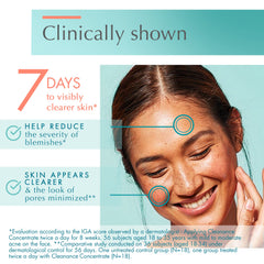 Avène Cleanance Concentrate gel texture swirl on skin absorbs quickly.