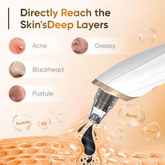 BAIIKO Blackhead Remover Vacuum showing three suction levels for customizable cleansing.