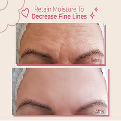 Bayside forehead wrinkle patches with reusable-material for comfortable night-time use.