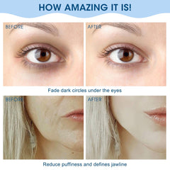 Bealihelp cooling face roller fridge-use, refreshing touch.