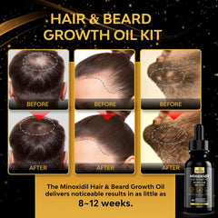 Beaueli Minoxidil 5% serum dropper for precise daily dosing.