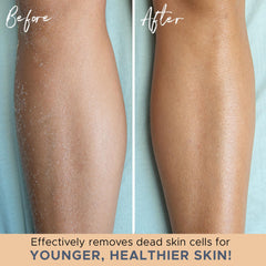 Beauty by Earth guante exfoliante; dos pares para cuidado corporal doble.