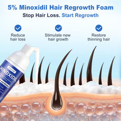 BEHATMH Minoxidil Foam 5% application close-up on thinning scalp.