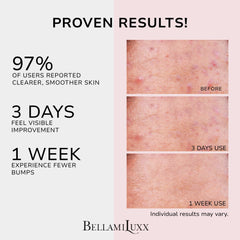 BellamiLuxx butt acne cream texture shown for gentle exfoliation and calming care.