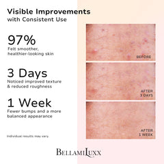 BellamiLuxx butt acne lotion tube smoothing rough patches