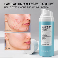 BellamiLuxx tea tree oil ingredient highlights natural calming properties for breakout-prone skin.