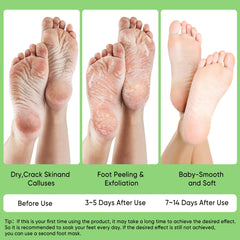 Mascarilla de aloe Berlaney para talones: relajación y suavidad aseguradas.