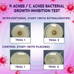 BIO'LEARY hydrocolloid spot cover on skin protects active pimples.