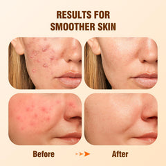 BIYSBER serum dropper close-up for precise dosage and gentle exfoliation.