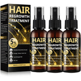 BLISSMATE minoxidil 5% spray, bote cercano, ayuda a mejorar la apariencia capilar con uso diario.