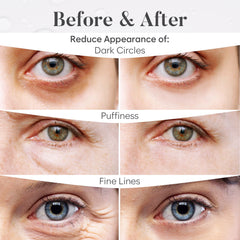 BLOOMORA parche ojos rosa para confort suave