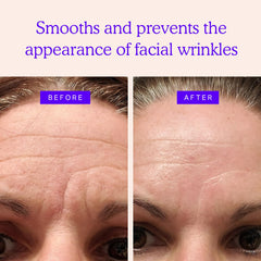 BLUMBODY forehead patch targeting wrinkles, blends invisibly