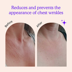BLUMBODY chest wrinkle pads on skin application for overnight smoothing.