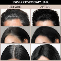 Boobeen root cover hairline demonstrating thinning edge concealment