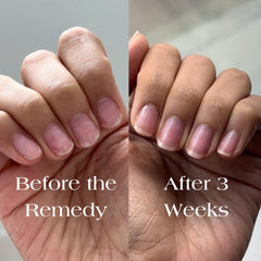 Botanist Nails Activos vegetales esqualano fortalecen las uñas.