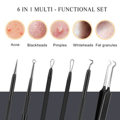 Boxoyx blackhead remover stainless steel tips ensure safe, rust-resistant extraction.