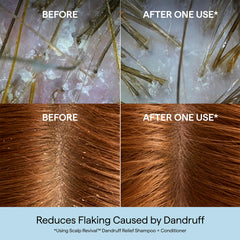 Briogeo 1.8% salicylic acid exfoliation shown on label for flakes support.