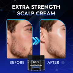 Calvris scalp cream lightweight absorption ideal for daily routines.