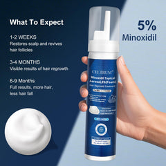 Celtrum Minoxidil con biotina, espuma 60 g para soporte del crecimiento capilar.