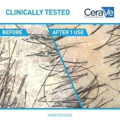 Etiqueta de CeraVe Anticaspa Hidratante destaca ceramidas para la barrera capilar