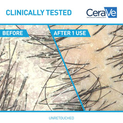 CeraVe Hydrating Anti Dandruff Shampoo ingredients ceramides niacinamide for barrier support