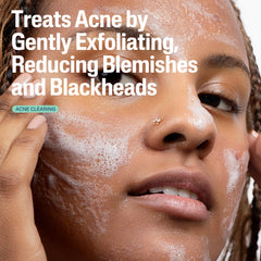 Cetaphil Gentle Clear: ácido salicílico al 2% para imperfecciones