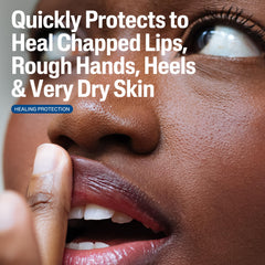 Ungüento Cetaphil: aplicación fácil en piel irritada.