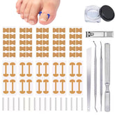 Chemailon ingrown toenail toolkit packaging shown for at-home care.