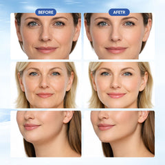 Chinology Double Chin Lifting Mask tightens the jawline for a defined contour.