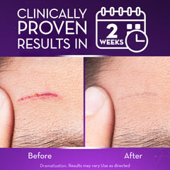 Cicatricure Advanced Scar Gel texture close-up highlights non-greasy absorption.