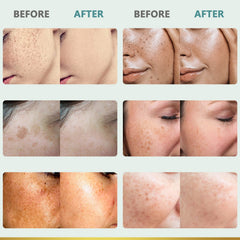 CITYGOO luminosidad natural del rostro para piel radiante.
