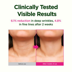 Tube of CKD neck cream emphasizing easy application and daily routine