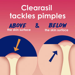 Clearasil Rapid Rescue: limpieza profunda que elimina aceite y suciedad de poros